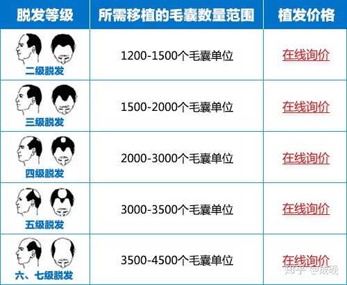 種頭發的價格之旅，探尋價格與自然的浪漫遨游